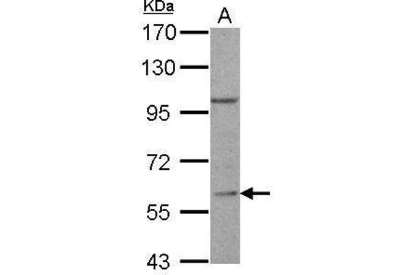 RGS14 anticorps  (C-Term)
