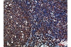 Immunohistochemical analysis of paraffin-embedded human-tonsil, antibody was diluted at 1:200