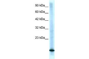 CDKN2B antibody (70R-10487) used at 0.