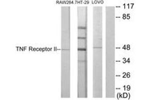 Western Blotting (WB) image for anti-Tumor Necrosis Factor Receptor Superfamily, Member 1B (TNFRSF1B) (AA 376-425) antibody (ABIN2889419) (TNFRSF1B anticorps  (AA 376-425))