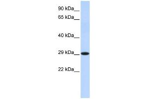 HSD17B14 antibody used at 1 ug/ml to detect target protein.