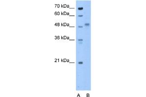 WB Suggested Anti-ZP4 Antibody Titration:  0. (ZP4 anticorps  (N-Term))