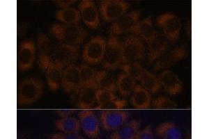 Immunofluorescence analysis of HeLa cells using RPL23A Polyclonal Antibody at dilution of 1:100. (RPL23A anticorps)