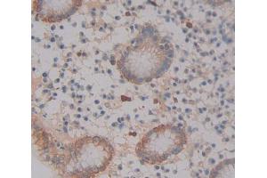 IHC-P analysis of Kidney tissue, with DAB staining. (ABCA12 anticorps  (AA 1346-1577))