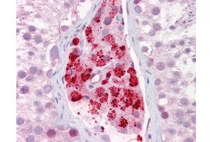 Anti-AURKA / Aurora-A antibody IHC of human testis.