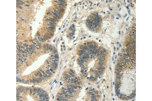 Immunohistochemistry (IHC) image for anti-Suppressor of Cytokine Signaling 5 (SOCS5) antibody (ABIN2428731) (SOCS5 anticorps)