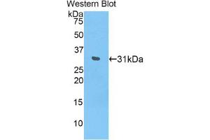 Western blot analysis of the recombinant protein. (IL17RD anticorps  (AA 356-603))