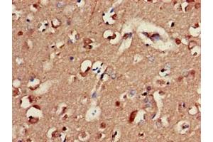 Immunohistochemistry of paraffin-embedded human brain tissue using ABIN7153479 at dilution of 1:100 (GABRA2 anticorps  (AA 29-251))