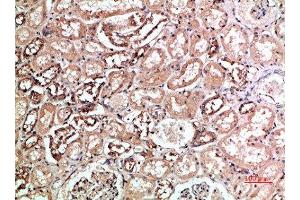Immunohistochemical analysis of paraffin-embedded human-kidney, antibody was diluted at 1:200 (KIR2DL5A anticorps  (AA 121-170))