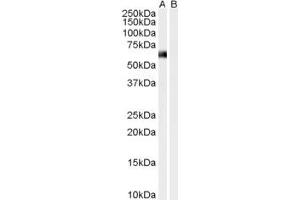 Western Blotting (WB) image for anti-Syntrophin, alpha 1 (Dystrophin-Associated Protein A1, 59kDa, Acidic Component) (SNTA1) (N-Term) antibody (ABIN2465307) (SNTA1 anticorps  (N-Term))