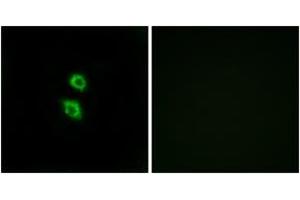 Immunofluorescence analysis of MCF7 cells, using ARSD Antibody. (Arylsulfatase D anticorps  (AA 331-380))