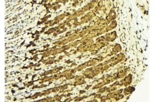 ABIN6269050 at 1/100 staining Human gastric tissue by IHC-P. (IKK alpha anticorps  (N-Term))
