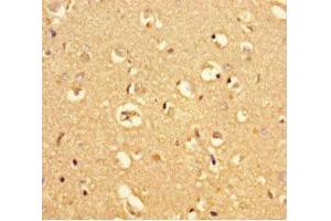 Immunohistochemistry of paraffin-embedded human brain tissue using ABIN7159225 at dilution of 1:100 (MRAP2 anticorps  (AA 66-205))