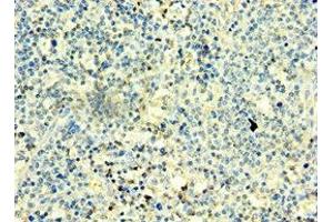 Immunohistochemistry of paraffin-embedded human thyroid tissue using ABIN7171313 at dilution of 1:100 (T-Box 22 anticorps  (AA 291-520))