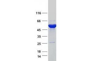 Validation with Western Blot