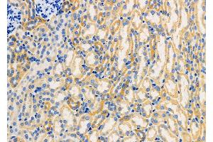 ABIN6259791 and ABIN6266850 at 1/100 staining Mouse kidney tissue by IHC-P. (ADCK1 anticorps  (Internal Region))