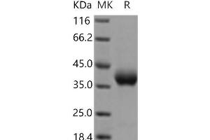 Prolactin Receptor (PRLR) protein (His tag)