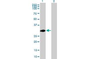 Western Blot analysis of CENPP expression in transfected 293T cell line by CENPP MaxPab polyclonal antibody. (CENPP anticorps  (AA 1-288))