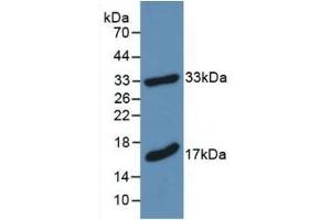 Detection of Recombinant MBP, Mouse using Polyclonal Antibody to Myelin Basic Protein (MBP) (MBP anticorps  (AA 18-222))