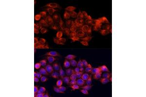 Immunofluorescence analysis of HeLa cells using ATG5 antibody. (ATG5 anticorps  (AA 1-275))