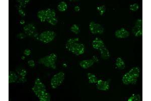 Image no. 5 for anti-Hexokinase 2 (HK2) antibody (ABIN1498647) (Hexokinase 2 anticorps)