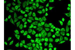 Immunofluorescence analysis of HeLa cell using IL7R antibody. (IL7R anticorps  (AA 21-239))