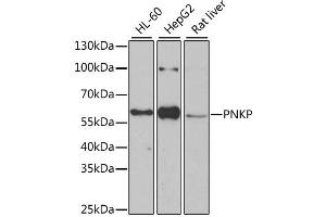 Western blot analysis of extracts of various cell lines, using PNKP antibody (ABIN2564598) at 1:1000 dilution. (PNKP anticorps)