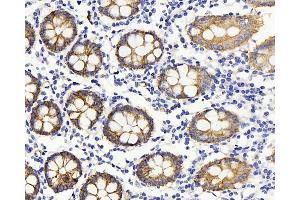 Immunohistochemistry analysis of paraffin-embedded human colon using Claudin 5 Polyclonal Antibody at dilution of 1:400. (Claudin 5 anticorps)