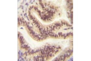 anti-Chromosome 16 Open Reading Frame 45 (C16orf45) (AA 89-119), (Middle Region) antibody