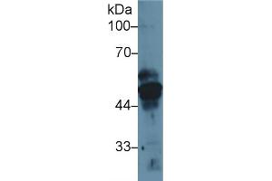 Western Blot; Sample: Human MCF7 cell lysate; Primary Ab: 1µg/ml Rabbit Anti-Rat KRT17 Antibody Second Ab: 0. (KRT17 anticorps  (AA 84-392))