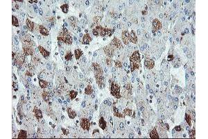 Immunohistochemical staining of paraffin-embedded Human liver tissue using anti-SDCBP mouse monoclonal antibody.