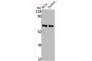 Western Blot analysis of HELA Jurkat cells using CYP4F2 Polyclonal Antibody