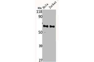 Western Blot analysis of HELA Jurkat cells using CYP4F2 Polyclonal Antibody (CYP4F2 anticorps  (N-Term))