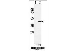 Western blot analysis of OGN using rabbit polyclonal OGN Antibody using 293 cell lysates (2 ug/lane) either nontransfected (Lane 1) or transiently transfected (Lane 2) with the OGN gene. (OGN anticorps  (C-Term))