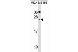 CIDEC Antibody (Center) (ABIN1538717 and ABIN2849747) western blot analysis in MDA-M cell line lysates (35 μg/lane). (CIDEC anticorps  (AA 97-126))