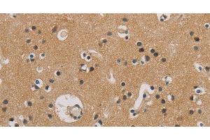 Immunohistochemistry of paraffin-embedded Human brain tissue using ITGB3BP Polyclonal Antibody at dilution 1:50 (ITGB3BP anticorps)