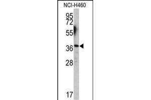Western blot analysis of EN2 antibody (C-term-2) (ABIN391666 and ABIN2841575) in NCI- cell line lysates (35 μg/lane). (EN2 anticorps  (C-Term))