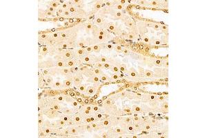 Immunohistochemistry of paraffin embedded mouse kidney using HES3 (ABIN7074159) at dilution of 1:1000 (400x lens) (HES3 anticorps)