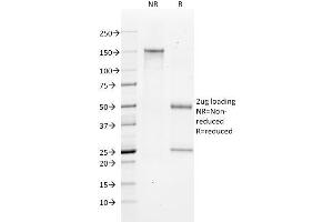 SDS-PAGE Analysis Purified Bax Mouse Monoclonal Antibody (2D2). (BAX anticorps  (AA 3-16))