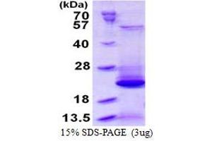 Image no. 1 for Biogenesis of Lysosomal Organelles Complex-1, Subunit 2 (BLOC1S2) protein (His tag) (ABIN1098274)