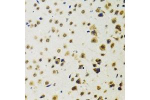 Immunohistochemistry of paraffin-embedded mouse brain using RUVBL2 antibody.