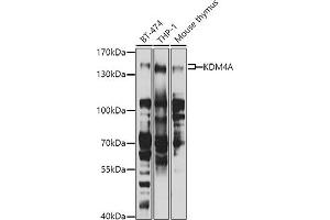 Western blot analysis of extracts of various cell lines, using KDM4A antibody (ABIN6131821, ABIN6142793, ABIN6142795 and ABIN6223960) at 1:1000 dilution. (KDM4A anticorps  (AA 585-815))