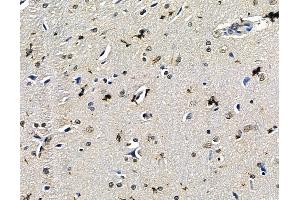 ABIN7096723 and ABIN7100788 at 1/100 staining rat brain tissue by IHC-P.