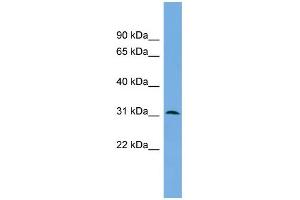 WB Suggested Anti-DAPP1 Antibody Titration: 0. (DAPP1 anticorps  (Middle Region))