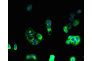 Immunofluorescent analysis of A431 cells using ABIN7144394 at dilution of 1:100 and Alexa Fluor 488-congugated AffiniPure Goat Anti-Rabbit IgG(H+L) (Apelin Receptor anticorps  (AA 309-380))