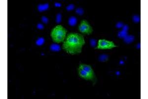 Image no. 2 for anti-Acetyl-CoA Acetyltransferase 2 (ACAT2) antibody (ABIN1496403) (ACAT2 anticorps)