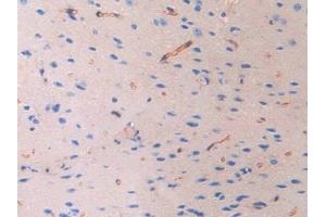 Detection of FBLN4 in Mouse Cerebrum Tissue using Polyclonal Antibody to Fibulin 4 (FBLN4)