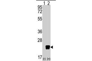 Western blot analysis of ARL3 (arrow) using rabbit ARL3 polyclonal antibody . (ARL3 anticorps  (C-Term))