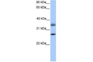 LGALS8 antibody used at 1 ug/ml to detect target protein. (LGALS8 anticorps)
