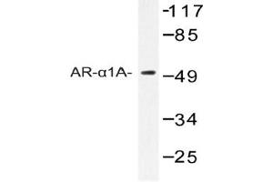 Image no. 1 for anti-Adrenoceptor alpha 1A (ADRA1A) antibody (ABIN272286) (alpha 1 Adrenergic Receptor anticorps)